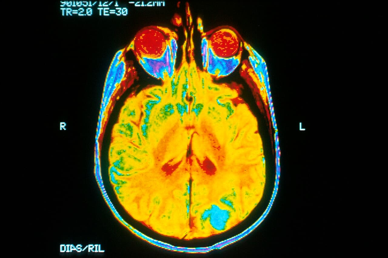 Brain Balance