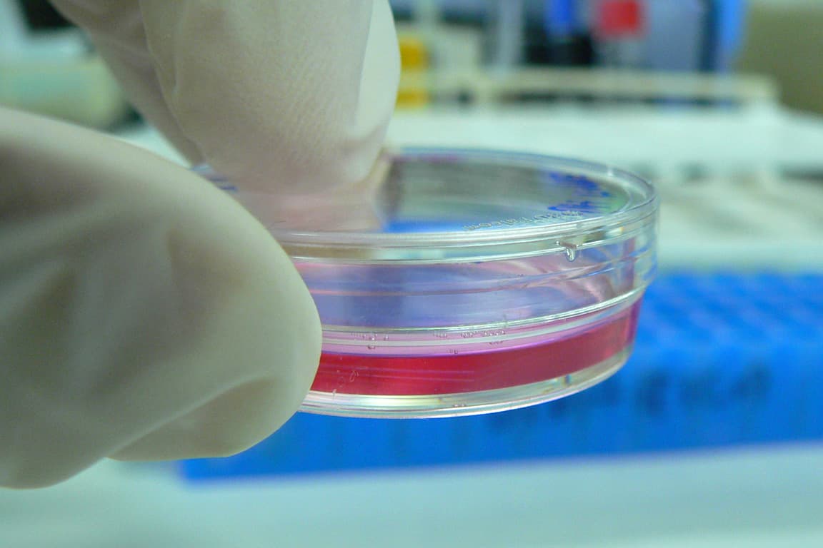 Stem Cell Therapy